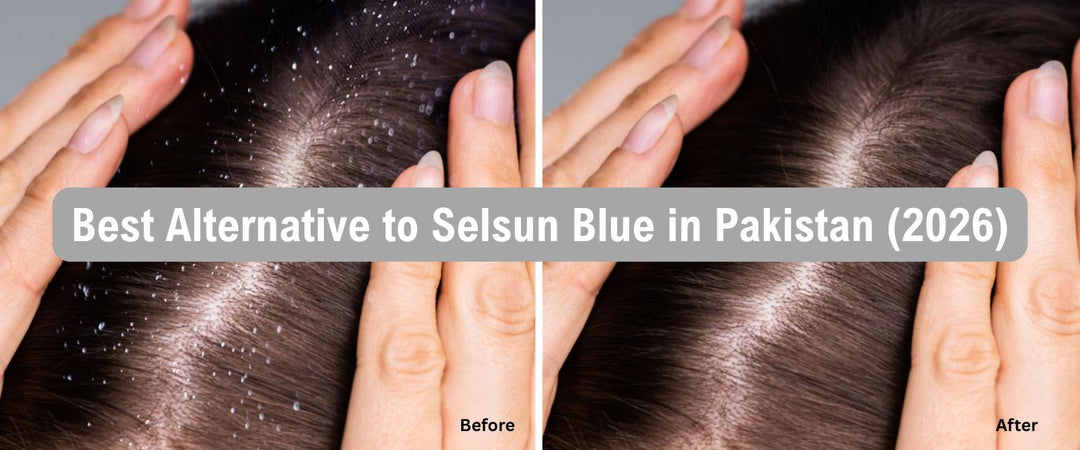 Best Alternative to Selsun Blue Shampoo in Pakistan (2026 Guide)