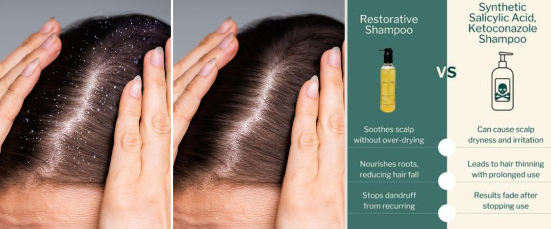 Conaz Shampoo in Pakistan – What It Does & Better Everyday Alternatives (2026)