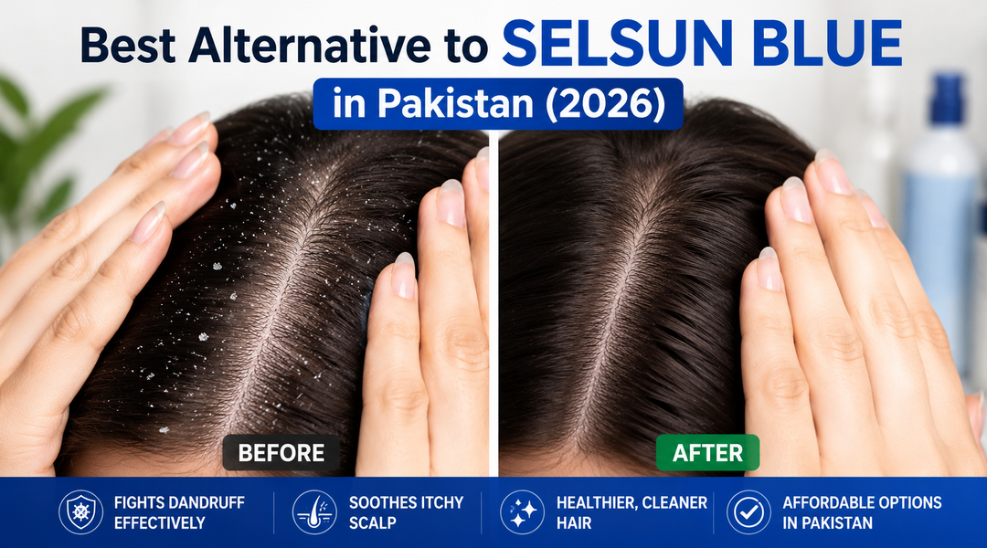 Best Alternative to Selsun Blue Shampoo in Pakistan (2026 Guide)